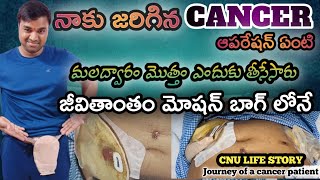 కడుపు మీద 6 రంద్రాలు పెట్టారుపెద్ద పేగు సగం తీసేసారు  colostomy surgery process in telugu [upl. by Prospero18]