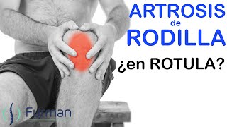 CONDROMALACIA ROTULIANA 😱 Artrosis de rodilla condropatia condromalacia patelar osteoartritis [upl. by Erodaeht]