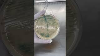 Burkholderia cepacia Trên Môi Trường Thạch UTI  Điều Bạn Cần Biết shorts labinsight [upl. by Anaytat230]