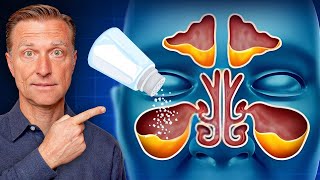 Rid Throat and Sinus Mucus with SALT [upl. by Aceber]