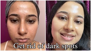 Best Dermatologist recommended Skincare Routine to remove Dark Spots Hyperpigmentation Acne Marks [upl. by Akenat]