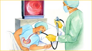 Endoscopic Procedure  Indications Types How It Is Done Risks And Complications [upl. by Rola709]