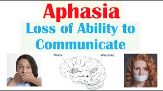 Aphasia  Types Broca’s Wernicke’s Global Causes Signs amp Symptoms Diagnosis Treatment [upl. by Teddie]