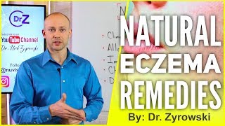 Natural Eczema Remedies  Actually Works [upl. by Rizika]