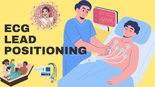 Mastering ECG Lead Placement [upl. by Leora]