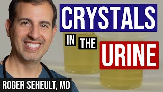 Review of Crystals Found in the Urine for Kidney Stones [upl. by Mclaughlin]