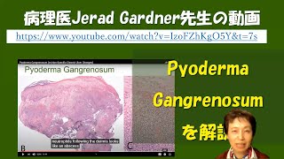 Pyoderma gangrenosumの病理組織像の解説動画 [upl. by Meirrak]