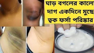 গোপন অঙ্গের কালোদাগ দূর করে ফর্সা করবেGopon jaiga poriskar korar upayPrivate part Whitening Remedy [upl. by Ayeki]