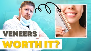 The Pros amp Cons of Dental Veneers  Are They Worth It [upl. by Eemiaj]