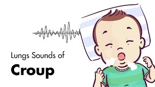 Sounds of Croup Laryngotracheitis  Lung Sounds  MEDZCOOL [upl. by Raseta693]