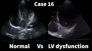 Test your skill Spot the difference between normal Vx abnormal [upl. by Deloris]