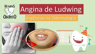 Angina de Ludwing  Urgências na Odontologia  Resumos de Odonto [upl. by Fortune426]