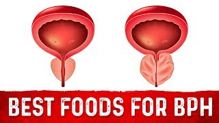 Best Foods For Benign Prostatic Hyperplasia BPH – DrBerg [upl. by Rochemont]