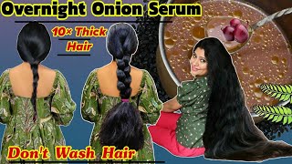 Overnight Onion Serum To Get 10×Thick Hair amp Regrow Lost Hair NaturallyGet Thick Hair।Garima Singh [upl. by Nero]