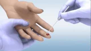 DPP® HIV 12 Assay  Whole Blood Sample [upl. by Halyk]