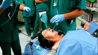 Awake Fiberoptic Intubation [upl. by Fasto]