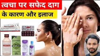 त्वचा पर सफेद दाग के कारण और इलाज  Leucoderma treatment Treatment Of White Patches leucoderma [upl. by Jaquenetta]