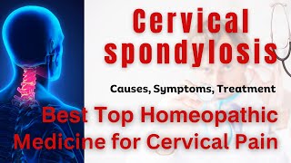 Cervical Spondylosis Causes Symptoms and Treatment in Hindi सर्वाइकल स्पॉन्डिलाइटिस Homeoapthic Dawa [upl. by Howenstein]