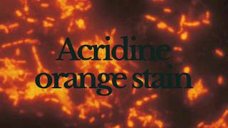 Acridine Orange Staining  Principle Method and Result [upl. by Nwahsad]