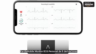 KardiaMobile Monitor ECG Personal de 6 derivaciones [upl. by Rettke596]