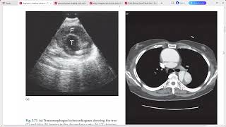 DIAGNOSTIC RADIOLOGY IMAGING [upl. by Maryann861]