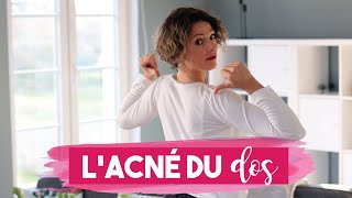 ACNE dans le DOS  5 CONSEILS pour vous en DEBARRASSER [upl. by Michaeu]