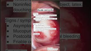 Acute cervicitis [upl. by Knowlton]