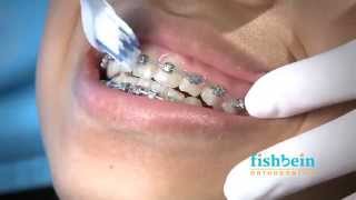 Orthodontic Home Care Instructions  Braces  Brushing [upl. by Attenyl]