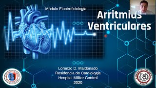 Arritmia ventriculares  Módulo electrofisiología [upl. by Sean]