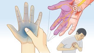 What Causes Tingling and Numbness in Hands and Feet [upl. by Mauro809]