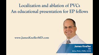 Localization and ablation of PVCsAn educational presentation for EP fellows [upl. by Einnij]