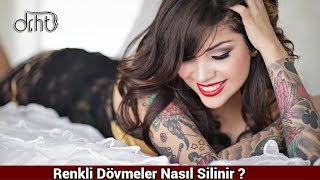 Renkli Dövmeler Nasıl Silinir [upl. by Braeunig924]