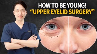 Can Upper Eyelid Surgery Change Your Life [upl. by Marcile]