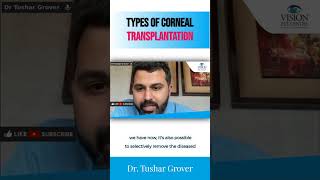 Types of Corneal Transplantation  Dr Tushar Grover [upl. by Ellenahc]