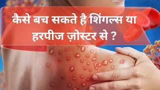 What is Shingles Disease Explained 101 Causes Symptoms and Treatment currentaffairs shingles [upl. by Johnsson]