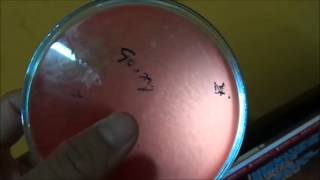 Estreptococos BHemolíticos en Cultivo Agar Sangre [upl. by Benedic697]