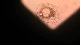 Rotifers and other micro species from a fish tank filter under microscopem2t [upl. by Kedezihclem]