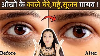 In 7 Days 💕 Remove DARK CIRCLES काले घेरे PUFFY EYES गड्ढे SUNKEN EYES Naturally  100 Results [upl. by Smiga235]