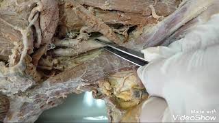 Carotid triangle dissection video [upl. by Feinberg]