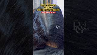 Permanent lice removal treatmentbest way to remove licehow to treat lice from hairtangle and lice [upl. by Spancake372]