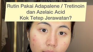 Rutin Pakai Adapalene  Tretinoin amp Azelaic Acid Kok Tetap Jerawatan [upl. by Iinden453]