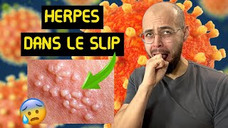 HERPES GENITAL  5 signes pour le reconnaitre [upl. by Aranat]