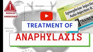 Treatment of Anaphylaxis  Medical Emergency  Must Know [upl. by Annohsal]