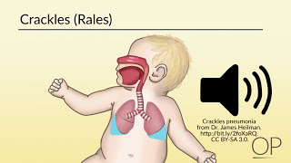 Infant Distress Warning Signs Grunting Baby Sound [upl. by Colner]