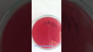 Bacterial culture  Bacterial growth on Media  Microbiology  Culture sensitivity test [upl. by Federico169]