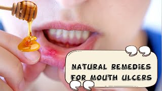 How To Relieve Mouth Ulcers Naturally And Effectively Natural Remedies For Mouth UlcersCanker Sore [upl. by Jerol]