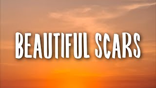 Maximillian  Beautiful Scars Lyrics [upl. by Refynnej]