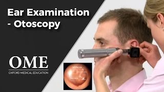 Otoscopy Ear Examination  ENT [upl. by Leblanc578]