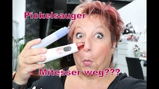 PickelPorensauger Test braucht man das wirklich Absaugen  Entfernung von Mitessern [upl. by Aelc]