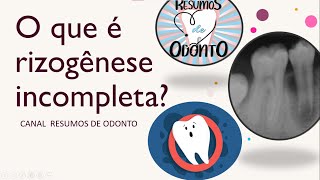 O que é rizogênese incompleta l Resumos de Odonto [upl. by Udenihc]